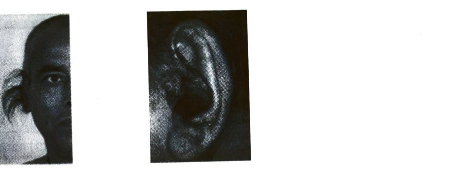 Two photographs of a human ear with long hairs growing on the rim of the pinna.