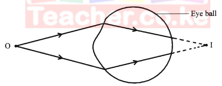 Figure 10: rays from a near object O enter the eye and would meet at I behind the retina.