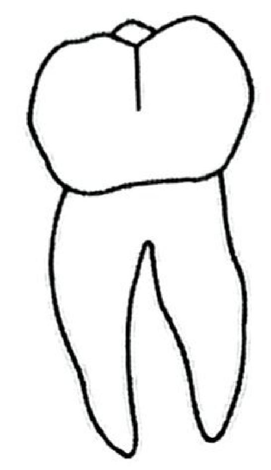 A mammalian tooth with a broad, cusped crown and two roots (a molar/premolar).