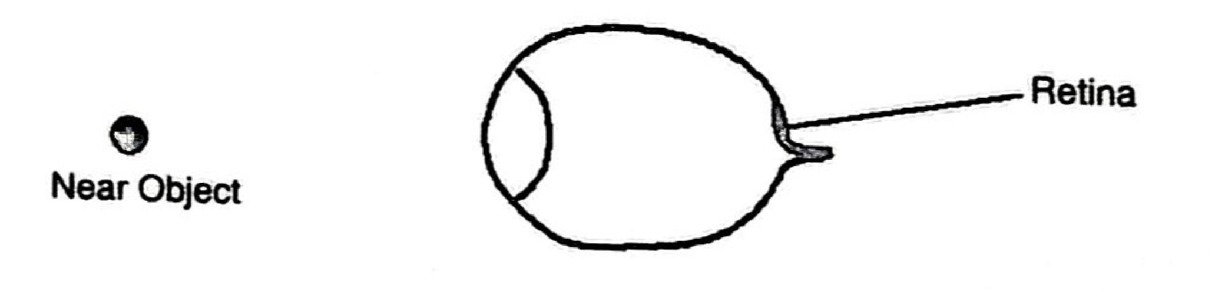Figure 1: a near object to the left of a long-sighted eye; the retina is labelled at the back of the eye.