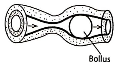 A section of gut with a bolus of food being pushed along by a wave of muscle contraction behind it.