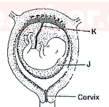 A foetus in the uterus: K labels the placenta on the uterine wall, J labels the fluid-filled amniotic cavity around the foetus; cervix below.